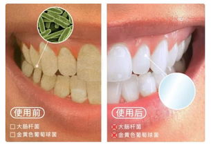 口腔清洁新革命 3秒去除口臭，连打嗝都是薄荷清香