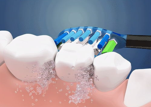 电动牙刷如何选择 全方位指南，助力牙齿清洁健康